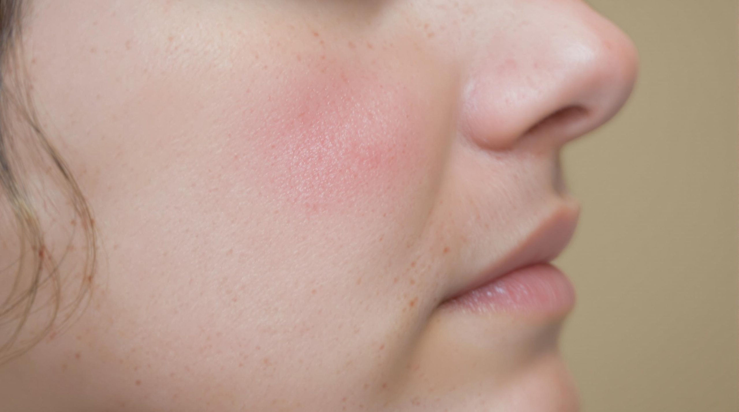 Bouton sur la joue : Signification et solutions - Construisez votre propre style de vie : Astuces pour créer une routine qui vous ressemble